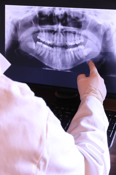 Best Emergency Dental Care for Broken or Chipped Teeth in Mariposa, CA