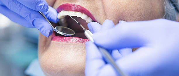 Best Emergency Gum Treatment in Mariposa, CA